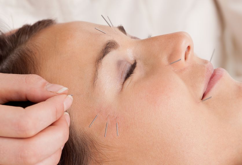 cosmetic acupuncture