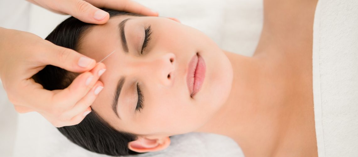 cosmetic acupuncture